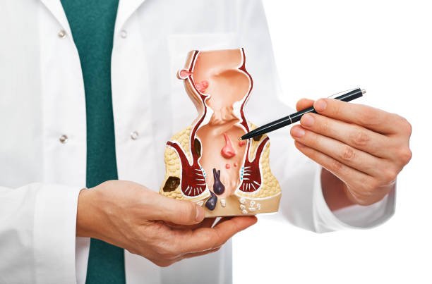 Best Hemorrhoids treatment UAE